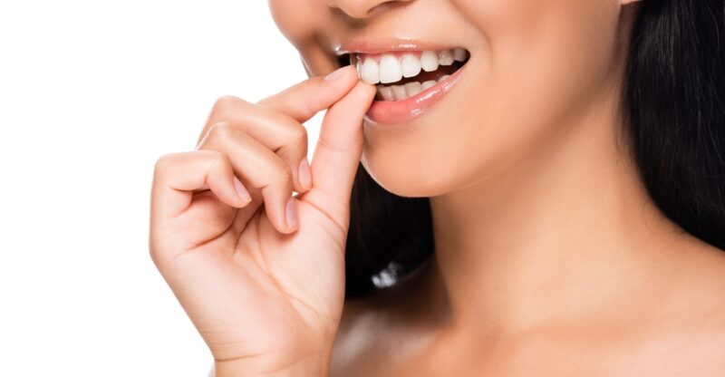 Can You Get Tooth Decay Under Veneers?